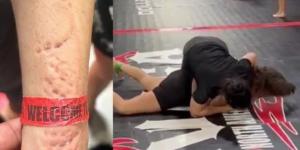 اعتداء وحشي.. لاعبة جوجتسو "تعض" منافستها خلال مباراة - المصدر 7