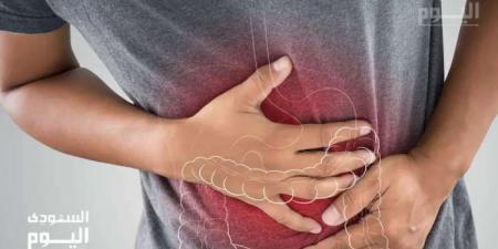 دراسة تحذر: الأطعمة فائقة المعالجة ترفع خطر الإصابة بسرطان القولون والمستقيم - المصدر 7