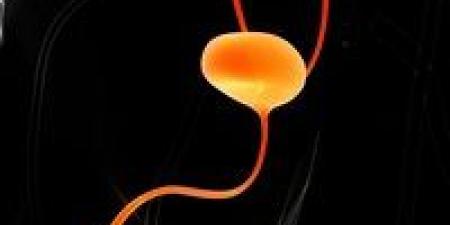 علاج ثوري يمحو أورام سرطان المثانة بالكامل لدى معظم المرضى - المصدر 7