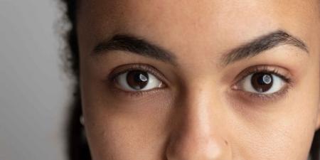 فيتامينات وعادات لتحسين الهالات السوداء تحت العين - المصدر 7