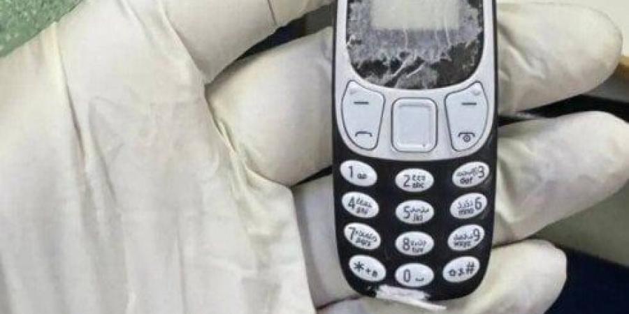 فريق طبي ينجح في استخراج هاتف محمول من بطن مريض ظل داخله 11 شهرا - المصدر 7