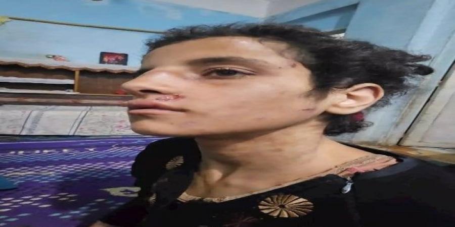 يرى فيها صورة زوجته الأولى.. السجن عامين لأب وزوجته عذبا طفلته في المنوفية - المصدر 7