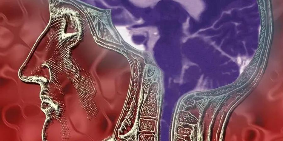 تسرب السائل النخاعي... عندما يفقد الدماغ درعه الواقي - المصدر 7