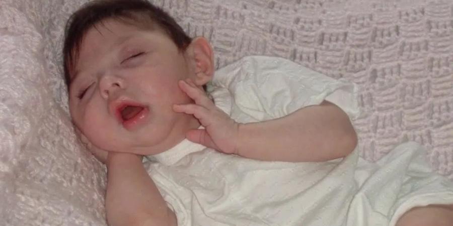 فتاة "المعجزة" تحتفل بعيدها العشرين متحدية توقعات الأطباء - المصدر 7