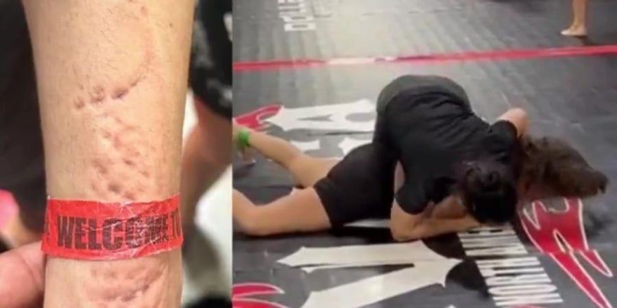 اعتداء وحشي.. لاعبة جوجتسو "تعض" منافستها خلال مباراة - المصدر 7