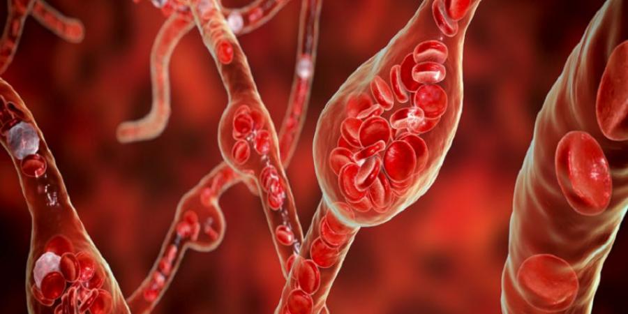 دواء قديم وشائع لضغط الدم قد يحد من نمو أورام الدماغ الخبيثة - المصدر 7