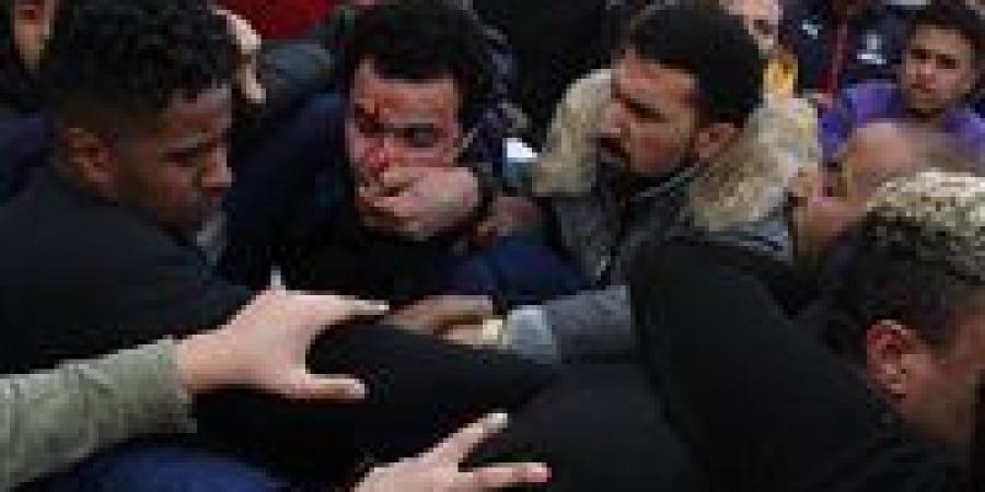 20 غرزة في الوجه والذراع.. تحريات تكشف تفاصيل اعتداء عاطل على زوجته بالقطامية - المصدر 7